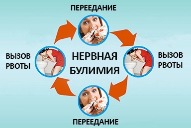 Лечение булимии в Пласте